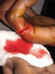 ਵਿਦਿਆਰਥੀਆਂ \'ਤੇ ਲਾਠੀਚਾਰਜ ਖਿਲਾਫ ਆਵਾਜ਼ ਬੁਲੰਦ