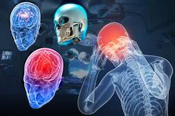 ਸਰੀਰ ਦੇ ਦੂਜੇ ਅੰਗਾਂ ਵਾਂਗ ਹੁਣ ਬਦਲਿਆ ਜਾ ਸਕੇਗਾ “ਸਿਰ”