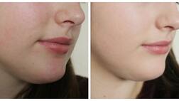 ਚਿਹਰੇ ਦੇ ਦਾਗ-ਧੱਬਿਆਂ ਲਈ ਕਮਾਲ ਦੇ ਘਰੇਲੂ ਨੁਸਖੇ