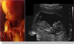 ਲਿੰਗ ਜਾਂਚ ਕਰਵਾਉਣ ਵਾਲੇ ਫੜਾਓ, ਲੱਖ ਰੁਪਏ ਇਨਾਮ ਪਾਓ