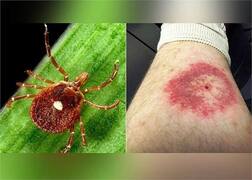 ਇਸ ਕੀੜੇ ਦੇ ਕੱਟਣ ਨਾਲ ਇਨਸਾਨ ਉਮਰ ਭਰ ਲਈ ਬਣ ਜਾਂਦਾ ਸ਼ਾਕਾਹਾਰੀ