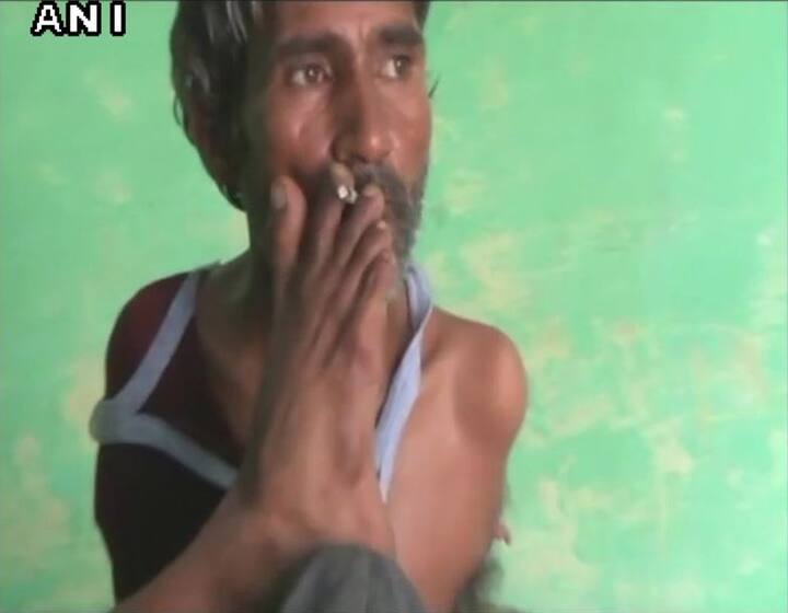 ਉਹ ਆਪਣੇ ਪੈਰਾਂ ਨਾਲ ਸਿਗਰਟ ਵੀ ਪੀ ਲੈਂਦੇ ਹਨ। 
