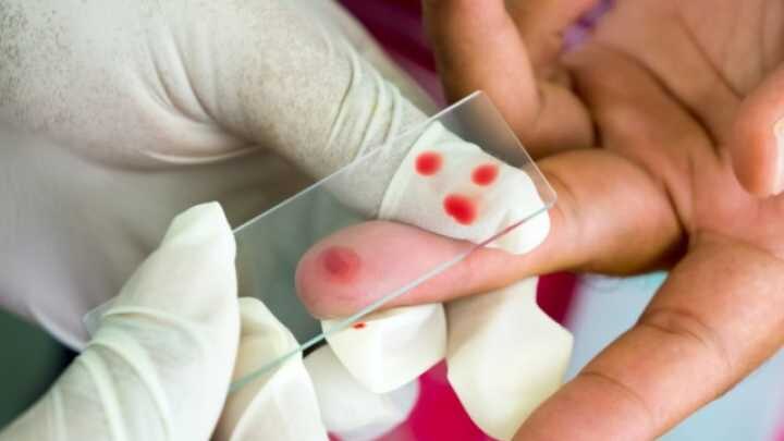 Kolkata Malaria Symptom Treatment Remedy Precaution Malaria : কলকাতায় ৮ মাসে ম্যালেরিয়া আক্রান্ত প্রায় ২.৫ হাজার, জানুন কী লক্ষণ, ঠিক সময়ে চিকিত্সা না করালে কী কী বিপদ