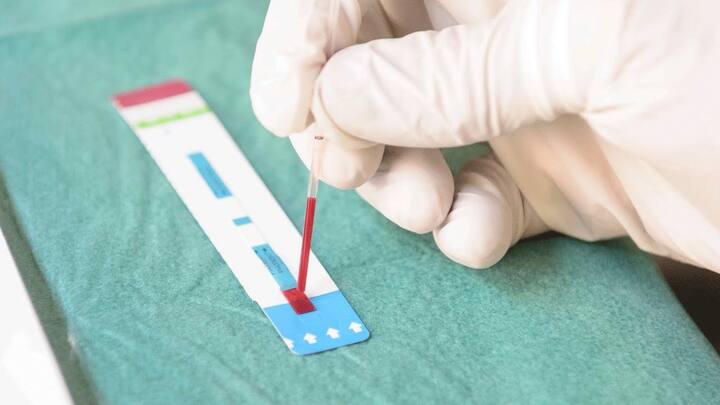 ਲੰਡਨ : ਵਿਗਿਆਨਕਾਂ ਨੇ ਸਮਾਰਟਫੋਨ ਆਧਾਰਤ ਇਕ ਨਵੀਂ ਜਾਂਚ ਵਿਕਸਿਤ ਕੀਤੀ ਹੈ। ਇਹ ਜਾਂਚ ਰੋਗੀ ਦੀ ਇਕ ਬੂੰਦ ਖ਼ੂਨ ਦੀ ਵਰਤੋਂ ਨਾਲ ਮਹਿਜ਼ 10 ਸਕਿੰਟਾਂ ਵਿਚ ਹੀ ਐੱਚਆਈਵੀ ਦਾ ਪਤਾ ਲਗਾ ਸਕਦੀ ਹੈ। 