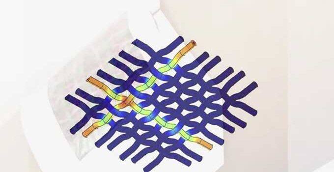 ਵਿਗਿਆਨਕਾਂ ਨੇ ਇਕ ਨਵੀਂ ਸਮਾਰਟ ਪੱਟੀ ਵਿਕਸਿਤ ਕੀਤੀ ਹੈ। ਇਹ ਪੱਟੀ ਖ਼ਾਸ ਤਰ੍ਹਾਂ ਦੇ ਜ਼ਖ਼ਮਾਂ ਲਈ ਦਵਾ ਦੀ ਖ਼ੁਰਾਕ ਤੇ ਇਸ ਨੂੰ ਦੇਣ ਦਾ ਸਮਾਂ ਨਿਰਧਾਰਤ ਕਰ ਸਕਦੀ ਹੈ। ਇਸ ਦੇ ਨਤੀਜੇ ਵਜੋਂ ਜ਼ਖ਼ਮ ਜਲਦੀ ਭਰ ਸਕਦਾ ਹੈ। 