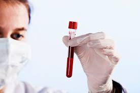 ਇਸ ਪ੍ਰਕਿਰਿਆ 'ਚ ਗੈਗ ਪ੍ਰੋਟੀਨ ਨਾਂ ਦੇ ਐਚਆਈਵੀ ਪ੍ਰੋਟੀਨ ਦੀ ਮੁਸ਼ਕਲ ਰਚਨਾ ਸ਼ਾਮਲ ਹੁੰਦੀ ਹੈ। ਸਾਡੀ ਟੀਮ ਨੇ ਇਕ ਕੰਪਿਊਟਰ ਮਾਡਲ ਬਣਾ ਕੇ ਗੈਗ ਦੀ ਪ੍ਰਕਿਰਿਆ ਦਾ ਪਤਾ ਲਾਇਆ। ਹੁਣ ਐਚਆਈਵੀ ਦਾ ਇਲਾਜ ਲੱਭਣਾ ਆਸਾਨ ਹੋਵੇਗਾ।