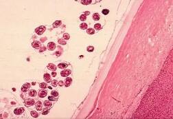 ਨਿਪਾਹ ਵਾਇਰਸ ਬਾਰੇ ਸਰਕਾਰ ਨੇ ਕੀਤਾ ਖਬਰਦਾਰ ! ਚਮਗਿੱਦੜ, ਸੂਰ, ਕੁੱਤੇ ਤੇ ਘੋੜੇ ਤੋਂ ਰਹੋ ਦੂਰ