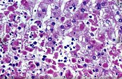 ਨਿਪਾਹ ਵਾਇਰਸ ਤੋਂ ਡਰੇ ਯੂਏਈ ਨੇ ਲਾਇਆ ਕੇਰਲ ਦੀਆਂ ਫਲ-ਸਬਜ਼ੀਆਂ 'ਤੇ ਬੈਨ