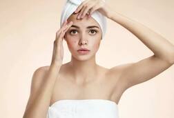 Skin Care Tips: Pimples ਤੋਂ ਛੁੱਟਕਾਰਾ ਪਾਉਣਾ ਹੈ ਤਾਂ ਖਾਓ ਇਹ ਚੀਜ਼ਾਂ