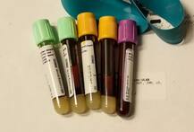 ਹੁਣ ਨਹੀਂ ਬੋਲ ਸਕੋਗੇ ਡਾਕਟਰ ਕੋਲ ਝੂਠ !