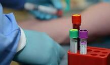 ਹੁਣ ਨਹੀਂ ਬੋਲ ਸਕੋਗੇ ਡਾਕਟਰ ਕੋਲ ਝੂਠ !