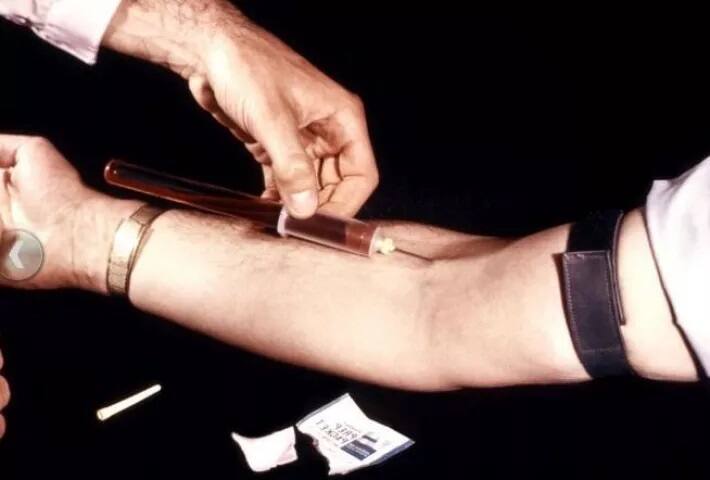 ਇਸ ਟੈਸਟ ਨੂੰ ਵਿਕਸਿਤ ਕਰਨ ਲਈ 329 ਲੋਕਾਂ ਦਾ ਟਰਾਇਲ ਲਿਆ ਗਿਆ ਜਿਸ ਵਿੱਚ ਮਰੀਜ਼ਾਂ ਦੀ ਖ਼ੁਰਾਕ ਬਾਰੇ ਉਨ੍ਹਾਂ ਨੂੰ ਪੁੱਛ ਕੇ ਟੈਸਟਾਂ ਦੇ ਨਤੀਜਿਆਂ ਦੀ ਤੁਲਨਾ ਕੀਤੀ ਗਈ ਸੀ। 