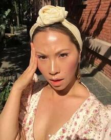 ਮਾਈਗ੍ਰੇਨ ਦਾ ਦਰਦ ਵੀ ਬਣਿਆ ਫ਼ੋਟੋ ਲੈਣ ਦਾ ਸਬੱਬ