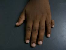 ਬਹੁਤ ਘੱਟ ਲੋਕਾਂ ਦੇ ਸਰੀਰ \'ਚ ਹੁੰਦੇ ਇਹ \'ਐਕਸਟ੍ਰਾ\' ਅੰਗ