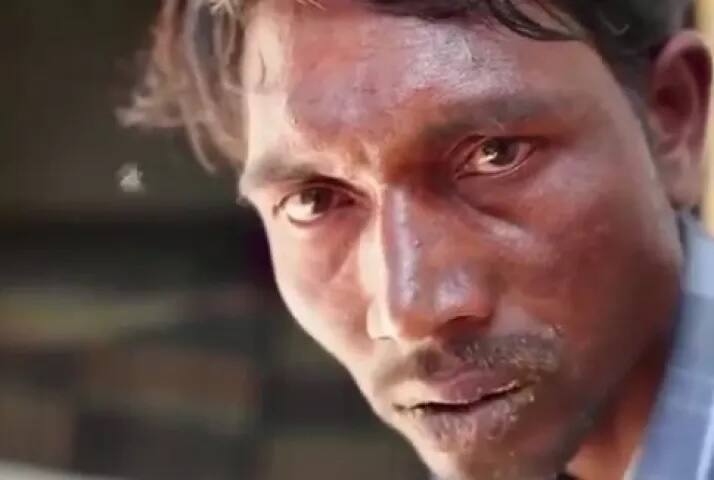 ਪਿੱਕੀਰੱਪਾ ਦੇ ਦੋਸਤ ਤੇ ਪਰਿਵਾਰ ਵਾਲੇ ਉਸਦੀ ਇਹ ਆਦਤ ਛੁਡਵਾਉਣ 'ਚ ਅਸਫਲ ਰਹੇ ਹਨ। ਹੁਣ ਪਿੱਕੀਰੱਪਾ ਆਪਣੀ ਇਸ ਆਦਤ ਨੂੰ ਟੈਲੇਂਟ ਬਣਾ ਚੁੱਕਾ ਹੈ ਤੇ ਉਹ ਆਸਪਾਸ ਦੇ ਪਿੰਡਾਂ 'ਚ ਜਾਕੇ ਇਹ ਚੀਜ਼ਾਂ ਖਾ ਕੇ ਲੋਕਾਂ ਨੂੰ ਦਿਖਾ ਕੇ ਪੈਸੇ ਇਕੱਠੇ ਕਰਦਾ ਹੈ।