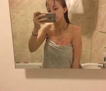 ਹੈਰਾਨੀਜਾਨਕ: ਇੱਕ ਕੁੜੀ ਨੂੰ ਅਜਿਹੀ ਬਿਮਾਰੀ ਨਾ ਨਹਾ ਸਕਦੀ, ਨਾ ਰੋ ਸਕਦੀ, ਨਾ ਧੁੱਪੇ ਰਹਿ ਸਕਦੀ ਤੇ ਨਾ ਹੀ ਝੂਠ ਬੋਲ ਸਕਦੀ..!