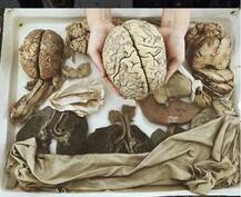 ਹੁਣ ਇਨਸਾਨੀ ਦਿਮਾਗ਼ ਨੂੰ ਛੋਹਣ ਤੋਂ ਲੈ ਕੇ ਤਸਵੀਰਾਂ ਵੀ ਖਿੱਚਵਾ ਸਕਦੇ ਹੋ, ਪੜ੍ਹੋ ਰੌਚਕ ਜਾਣਕਾਰੀ