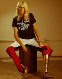 ਮਾਡਲ ਨੂੰ ਇੱਕ ਗਲਤੀ ਕਰਕੇ ਗਵਾਉਣੇ ਪਏ ਦੋਵੇਂ ਪੈਰ