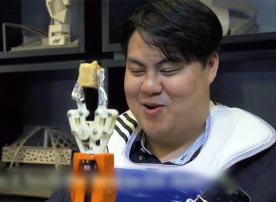 ਵਿਗਿਆਨ ਦਾ ਕ੍ਰਿਸ਼ਮਾ: ਹੁਣ ਮਨੁੱਖਾਂ ਨੂੰ ਲੱਗੇਗੀ ਤੀਜੀ ਬਾਂਹ !