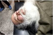 ਹਾਰ ਤੋਂ ਦੁਖ਼ੀ ਹੋ ਨਵੇਂ ਬਣੇ ਸਰਪੰਚ ’ਤੇ ਜਾਨਲੇਵਾ ਹਮਲਾ, ਭੰਨ੍ਹੀਆਂ ਲੱਤਾਂ