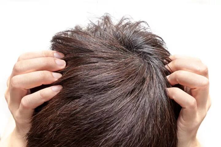 ਸਫੈਦ ਵਾਲ ਤੋੜਨ ਨਾਲ ਦੋ ਹੋਰ ਸਫੈਦ ਨਾਲ ਆ ਜਾਂਦੇ ਹਨ, ਇਹ ਵੀ ਸਿਰਫ ਮਿੱਥ ਹੀ ਹੈ। 