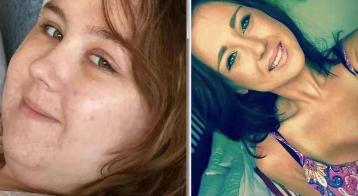 ਐਮਿਲੀ ਦਾ ਕਹਿਣਾ ਹੈ ਕਿ ਇਹ ਸਭ ਕੈਂਸਰ ਦੇ ਇਲਜ ਦੌਰਾਨ 6 ਹਫਤੇ ‘ਚ ਸਟੀਰਾਈਡ ਖਾਣ ਕਰਕੇ ਵਧੇ ਉਸ ਦੇ ਵਜ਼ਨ ਕਰਕੇ ਹੋਇਆ ਹੈ। ਐਮਿਲੀ ਦਾ ਇਸ ਦੌਰਾਨ 31 ਕਿਲੋ ਵਜ਼ਨ ਵਧੀਆ।