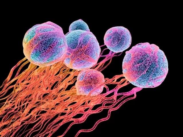 ਅੱਜ ਵਿਸ਼ਵ ਕੈਂਸਰ ਦਿਵਸ (World Cancer Day) ਹੈ। ਅੱਜ ਦੇ ਲਾਈਫਸਟਾਈਲ ਤੇ ਭੱਜ-ਨੱਠ ਵਾਲੀ ਜ਼ਿੰਦਗੀ ਵਿੱਚ ਕੈਂਸਰ ਬੇਹੱਦ ਆਮ ਹੋ ਗਿਆ ਹੈ। ਕੈਂਸਰ ਉਦੋਂ ਹੁੰਦਾ ਹੈ ਜਦ ਸੈੱਲਾਂ ਦਾ ਇੱਕ ਗਰੁੱਪ ਗ਼ੈਰ-ਕੁਦਰਤੀ ਤਰੀਕੇ ਨਾਲ ਸਰੀਰ ਵਿੱਚ ਵਧਣ ਲਗਦਾ ਹੈ ਤੇ ਸਰੀਰ ਦੇ ਕਈ ਹਿੱਸਿਆਂ ਨੂੰ ਪ੍ਰਭਾਵਤ ਕਰ ਸਕਦਾ ਹੈ। ਭਾਰਤ ਵਿੱਚ ਔਰਤਾਂ ਅੰਦਰ ਛਾਤੀਆਂ ਦਾ ਕੈਂਸਰ ਬੇਹੱਦ ਆਮ ਹੈ ਤੇ ਪੁਰਸ਼ਾਂ ਵਿੱਚ ਪਤਾਲੂ ਯਾਨੀ ਪ੍ਰੋਸਟੇਟ ਕੈਂਸਰ ਸਭ ਤੋਂ ਆਮ ਹੈ। ਇੰਨਾ ਹੀ ਨਹੀਂ ਫੇਫੜਿਆਂ ਦਾ ਕੈਂਸਰ, ਮੂੰਹ ਦਾ ਕੈਂਸਰ ਤੇ ਚਮੜੀ ਦਾ ਕੈਂਸਰ ਵੀ ਭਾਰਤ ਵਿੱਚ ਆਮ ਗੱਲ ਹੈ।