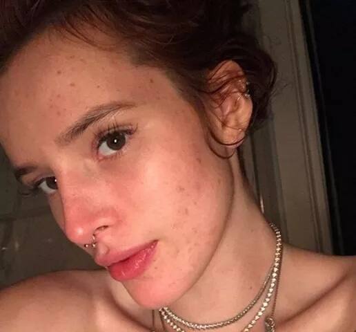 ਅਦਾਕਾਰਾ ਬੇਲਾ ਥ੍ਰੋਨ ਨੇ ਆਪਣੀ ਇਹ ਤਸਵੀਰ ਇੰਸਟਾ ’ਤੇ ਪੋਸਟ ਕਰਦਿਆਂ ਲਿਖਿਆ ਕਿ ਲੋਕ ਸੋਚਦੇ ਹਨ ਕਿ ਸਿਤਾਰਿਆਂ ਦੀ ਚਮੜੀ ਪਰਫੈਕਟ ਹੁੰਦੀ ਹੈ ਪਰ ਇਹ ਸਿਰਫ ਇੱਕ ਕਲਪਨਾ ਹੀ ਹੈ।