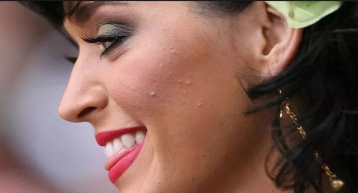 ਗਾਇਕਾ ਕੇਟੀ ਪੇਰੀ ਨੂੰ ਨੀ ਕਿੱਲਾਂ ਨੇ ਖ਼ੁਦ ਨੂੰ ਛੁਪਾਉਣ ਲਈ ਮਜਬੂਰ ਕਰ ਦਿੱਤਾ ਸੀ।