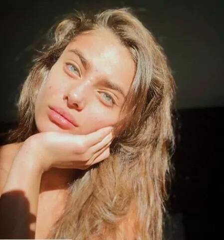 ਮਾਡਲ ਟੇਲਰ ਹਿੱਲ ਨੇ ਦੱਸਿਆ ਕਿ 15 ਸਾਲ ਦੀ ਉਮਰ ਵਿੱਚ ਹੀ ਉਸ ਨੂੰ ਪਿੰਪਲਜ਼ ਦੀ ਸਮੱਸਿਆ ਹੋ ਗਈ ਸੀ ਜੋ ਲੰਮੇ ਸਮੇਂ ਤਕ ਚੱਲੀ।