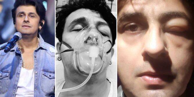 ਸੋਨੂੰ ਨਿਗਮ ਦੀ ਵਿਗੜੀ ਸ਼ਕਲ, ਹਸਪਤਾਲ ਦਾਖਲ Sonu Nigam hospitalized over severe health issue ਸੋਨੂੰ ਨਿਗਮ ਦੀ ਵਿਗੜੀ ਸ਼ਕਲ, ਹਸਪਤਾਲ ਦਾਖਲ