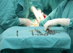 ਮਹਿਲਾ ਦੇ ਖੱਬੇ ਪੈਰ 'ਚ ਸੀ ਸਮੱਸਿਆ, ਡਾਕਟਰ ਨੇ ਸੱਜੇ ਪੈਰ ਦਾ ਕੀਤਾ ਆਪ੍ਰੇਸ਼ਨ