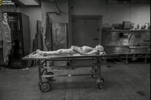 87 ਸਾਲਾ ਔਰਤ ਵੱਲੋਂ ਦਾਨ ਕੀਤੇ ਸ਼ਰੀਰ ਦੇ ਕੀਤੇ 27 ਹਜ਼ਾਰ ਟੋਟੇ