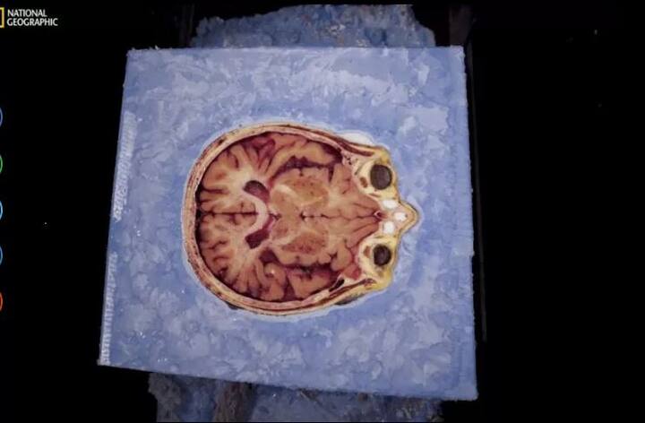 ਡਾਕਟਰਾਂ ਨੇ ਇਸ ਦਾ ਖੁਲਾਸਾ ਕੀਤਾ ਕਿ ਸੁਸੇਨ ਦੀ ਬੌਡੀ ਦੇ 27 ਹਜ਼ਾਰ ਟੁਕੜੇ ਕੀਤੇ ਜਾਣਗੇ ਜਿਸ ਨਾਲ ਸਟੂਡੈਂਟਸ ਨੂੰ ਪ੍ਰੈਕਟਿਕਲ ਪ੍ਰੋਜੈਕਟ ਕਰਨ ‘ਚ ਮਦਦ ਮਿਲ ਸਕੇ। ਇਸ ਤੋਂ ਬਾਅਦ ਉਸ ਦੇ ਸ਼ਰੀਰ ਦਾ ਡਿਜੀਟਲ ਰਿਕਾਰਡ ਰੱਖਿਆ ਜਾਵੇਗਾ ਅਤੇ ਹਰ ਪਾਰਟ ਕੰਪਿਊਟਰ ਨਾਲ ਸਕੈਨ ਹੋਵੇਗਾ।