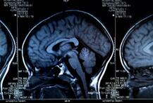 ਡਾਕਟਰ ਭੁੱਲੇ ਮਰੀਜ਼ ਨੂੰ ਬਿਮਾਰੀ ਬਾਰੇ ਦੱਸਣਾ, 19 ਮਹੀਨੇ ਬਾਅਦ ਪਤਾ ਲੱਗਾ ਤਾਂ....