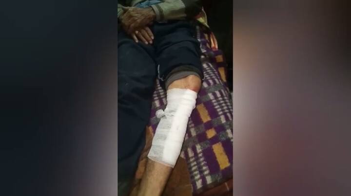 ਇਸ ਪਿੱਛੋਂ ਗੁੱਸੇ ਵਿੱਚ ਆਏ ਲੋਕਾਂ ਨੇ ਗੱਡੀ ਦਾ ਪਿੱਛਾ ਕੀਤਾ ਅਤੇ ਇੱਟਾ-ਰੋੜਿਆਂ ਤੇ ਬੇਸਬਾਲ ਨਾਲ ਗੱਡੀ ਦੇ ਸ਼ੀਸ਼ੇ ਭੰਨ੍ਹ ਦਿੱਤੇ। 