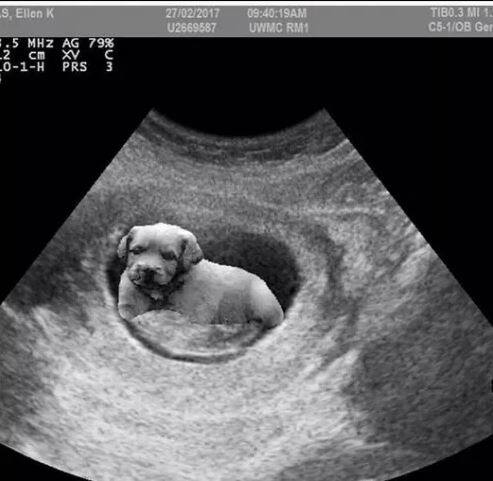 ਇਨ੍ਹਾਂ ਤਸਵੀਰਾਂ ‘ਚ ਉਸ ਦੀ ਪਤਨੀ ਨੇ ਆਲੇ-ਦੁਆਲੇ ਕੁਝ ਡਾਕਟਰ ਵੀ ਖੜ੍ਹੇ ਨਜ਼ਰ ਆ ਹਨ। ਇਸ ਨੂੰ ਦੇਖ ਲੱਗਦਾ ਹੈ ਕਿ ਉਹ ਕਿਸੇ ਕਲੀਨਕ ਦੀ ਫੋਟੋ ਹੈ।