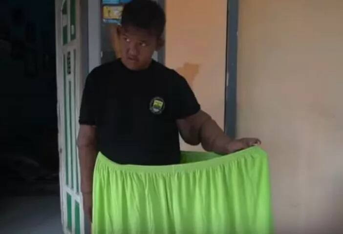 ਹੁਣ ਉਸ ਦੀ ਵਾਧੂ ਚਮੜੀ ਨੂੰ ਹਟਾਇਆ ਜਾਏਗਾ।
