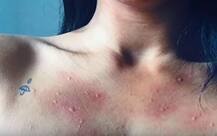 ਮਾਂ ਬਣਦਿਆਂ ਮੁਟਿਆਰ ਨੂੰ ਹੋਈ ਅਜੀਬ ਬਿਮਾਰੀ ਜਿਸ ਤੋਂ ਦੁਨੀਆ \'ਚ ਸਿਰਫ 40 ਲੋਕ ਨੇ ਪੀੜਤ