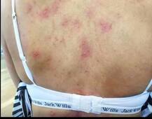 ਮਾਂ ਬਣਦਿਆਂ ਮੁਟਿਆਰ ਨੂੰ ਹੋਈ ਅਜੀਬ ਬਿਮਾਰੀ ਜਿਸ ਤੋਂ ਦੁਨੀਆ \'ਚ ਸਿਰਫ 40 ਲੋਕ ਨੇ ਪੀੜਤ