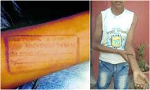 ਪ੍ਰਾਈਵੇਟ ਸਕੂਲ ਦਾ ਸ਼ਰਮਨਾਕ ਕਾਰਾ, ਬੱਚੇ ਦੀ ਬਾਂਹ \'ਤੇ ਲਿਖਿਆ ਫੀਸ ਜਮ੍ਹਾਂ ਕਰਵਾਓ