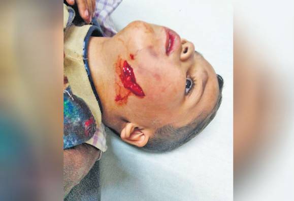 ਗੁਆਂਢੀ ਦੇ ਪਿੱਟਬੁੱਲ ਕੁੱਤੇ ਨੇ ਚਾਰ ਸਾਲ ਦੇ ਮਾਸੂਮ ਨੂੰ ਨੋਚਿਆ