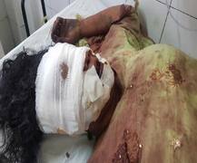 ਜਲੰਧਰ \'ਚ ਭਰਾ ਨੇ ਹੀ ਢਾਹਿਆ ਭੈਣ \'ਤੇ ਕਹਿਰ, ਦੋਵੇਂ ਅੱਖਾਂ ਕੱਢੀਆਂ