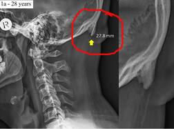 ਮੋਬਾਈਲ ਦਾ ਅਸਰ! ਮਨੁੱਖ ਦਾ ਤੇਜ਼ੀ ਨਾਲ ਬਦਲ ਰਿਹਾ ਸਰੀਰਕ ਢਾਂਚਾ