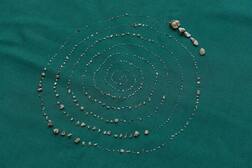 ਡਾਕਟਰਾਂ ਨੇ ਸੱਤ ਸਾਲਾ ਬੱਚੇ ਦੇ ਮੂੰਹ 'ਚੋਂ ਕੱਢੇ 526 ਦੰਦ, ਯਕੀਨ ਕਰਨਾ ਨਾਮੁਮਕਿਨ