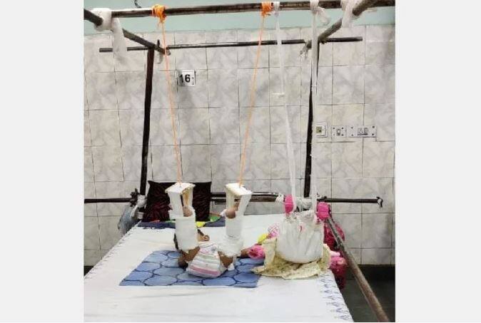 ਦੋਵਾਂ ਪੈਰਾ ਨੂੰ ਪੱਟੀ ਨਾਲ ਲਟਕਾਇਆ ਗਿਆ ਹੈ ਤਾਂ ਜੋ ਫਰੈਕਚਰ ਨੂੰ ਸਹੀ ਤਰ੍ਹਾਂ ਜੋੜਿਆ ਜਾ ਸਕੇ। ਇਸੇ ਤਰ੍ਹਾਂ ਬੱਚੀ ਦੀ ਗੁੱਡੀ ਨਾਲ ਵੀ ਕੀਤਾ ਗਿਆ ਹੈ। ਬੱਚੀ ਨੂੰ ਹਸਪਤਾਲ ‘ਚ ਸਭ ‘ਗੁੱਡੀ ਵਾਲੀ ਬੱਚੀ’ ਕਹਿ ਕੇ ਬੁਲਾਉਂਦੇ ਹਨ।