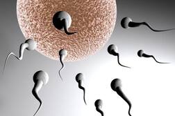 ਲੰਬੇ ਵਿਅਕਤੀ ਤੋਂ ਲਿਆ ਸਪਰਮ, ਵਰਤਿਆ ਭਾਣਾ, ਔਰਤ ਨੇ ਠੋਕਿਆ ਮੁਕੱਦਮਾ