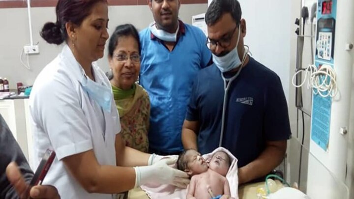 Woman gives birth in MP to boy with 2 heads, 3 hands ਔਰਤ ਨੇ ਦਿੱਤਾ ਦੋ ਸਿਰ ਤੇ ਤਿੰਨ ਹੱਥਾਂ ਵਾਲੇ ਬੱਚੇ ਨੂੰ ਜਨਮ