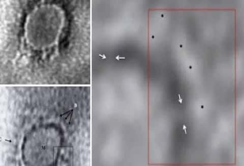 ਕੋਰੋਨਾਵਾਇਰਸ ਦੀ ਮਾਈਕਰੋਸਕੋਪੀ ਫੋਟੋ, ਭਾਰਤੀ ਵਿਗਿਆਨੀਆਂ ਨੂੰ ਮਿਲੀ ਵੱਡੀ ਕਾਮਯਾਬੀ