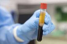 ਕੋਰੋਨਾ ਦੇ ਕਹਿਰ 'ਚ ਕੇਜਰੀਵਾਲ ਨੇ ਸੁਣਾਈ ਰਾਹਤ ਦੀ ਖ਼ਬਰ, ਪਲਾਜ਼ਮਾ ਥੈਰੇਪੀ ਬਣ ਰਹੀ ਵਰਦਾਨ